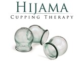 Hijama Cupping